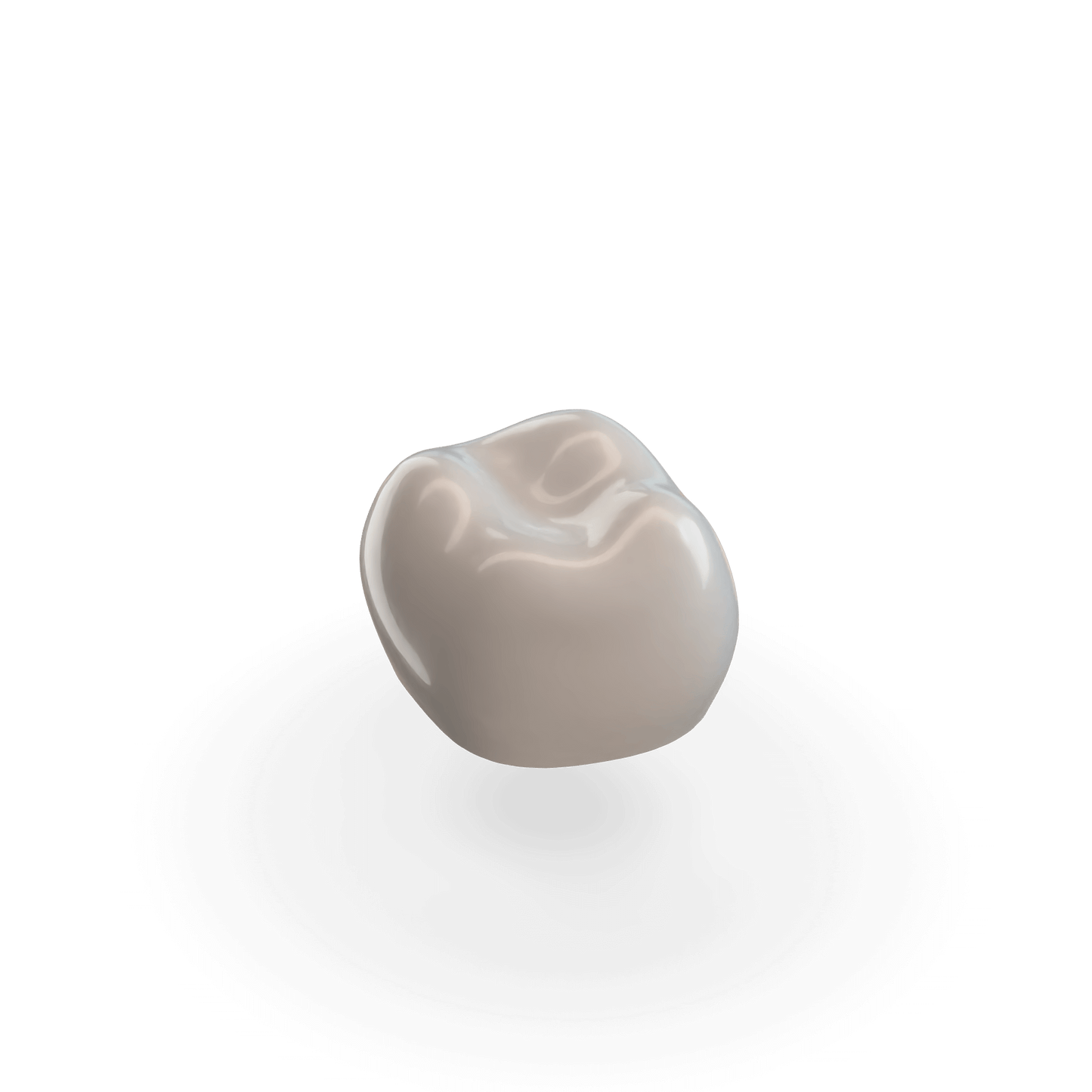 First Molar (LRD) Refill Crown