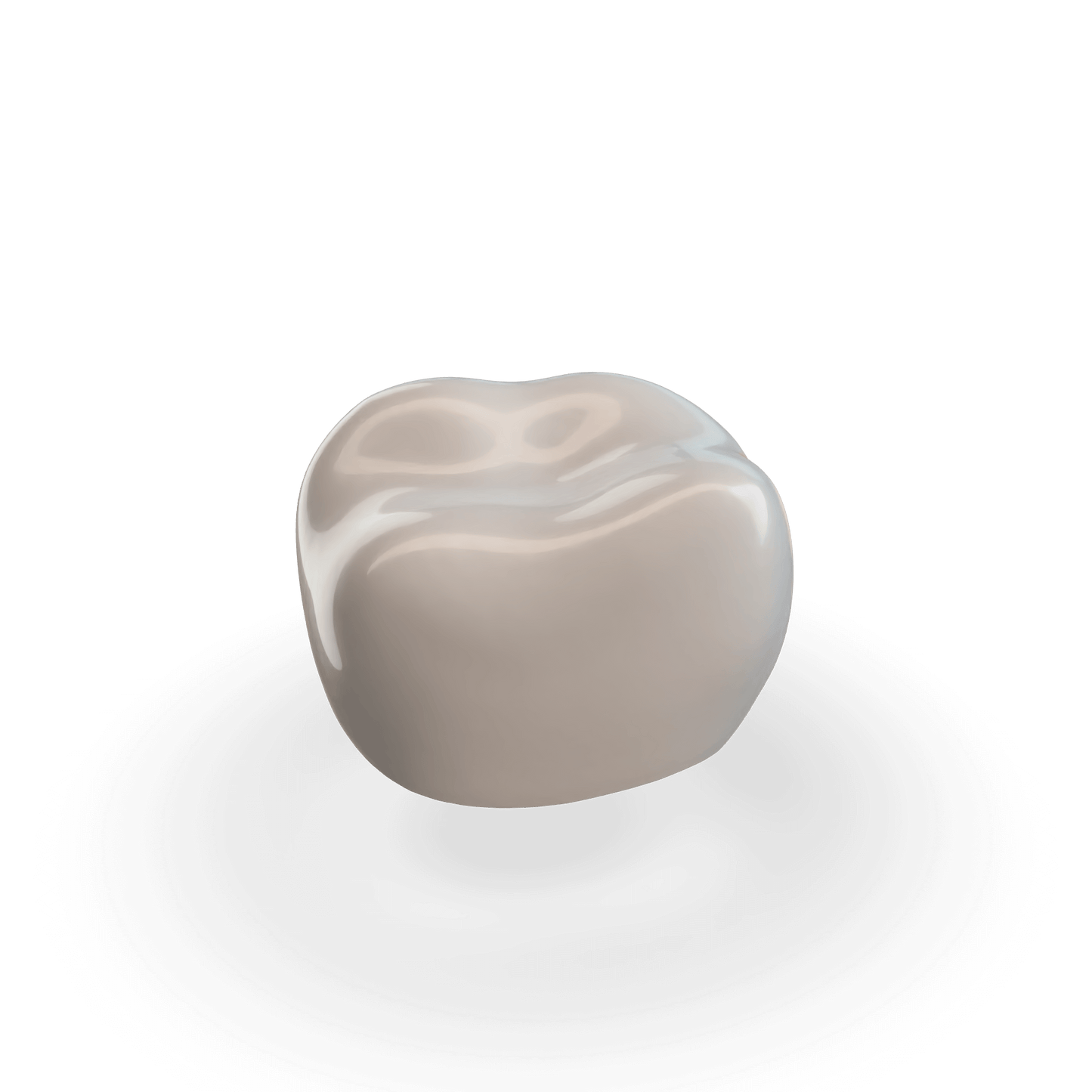 Second Molar (URE) Refill Crown