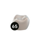 Second Molar (ULE) Refill Crown