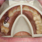 Miratray Implant
